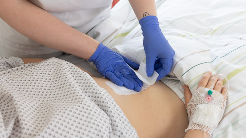 Pflegekraft mit blauen Handschuhen wechselt Wundverband am Bauch eines Patienten mit liegendem Venenzugang.